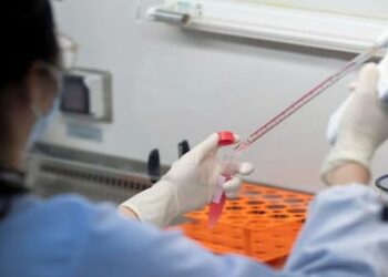 ರಾಜ್ಯದಲ್ಲಿ ಮತ್ತೊಬ್ಬರಿಗೆ ಕಾಲರಾ ಸೋಂಕು ದೃಢ: ಒಟ್ಟು ಕಾಲರಾ ಸೋಂಕಿತರ ಸಂಖ್ಯೆ 10ಕ್ಕೆ ಏರಿಕೆ..!!