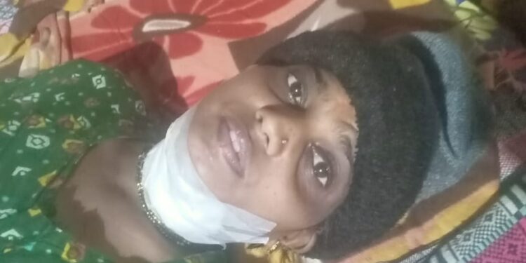 ಕಾರ್ಕಳ :ಮಹಿಳೆಯ ಚಿಕಿತ್ಸೆ ಗೆ ಬೇಕಾಗಿದೆ ನೆರವಿನ ಹಸ್ತ..!!