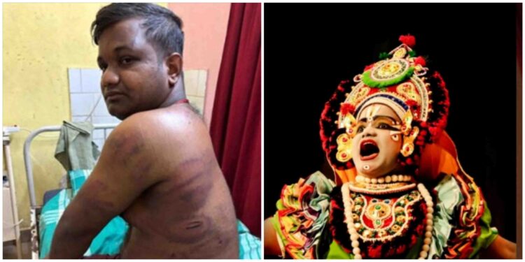 ಪಡುಬಿದ್ರೆ :ಸಾಲದ ವಿಚಾರಕ್ಕೆ ಸಂಬಂಧಿಸಿದಂತೆ ಯಕ್ಷಗಾನ ಕಲಾವಿದನ ಮೇಲೆ ಹಲ್ಲೆ..!!