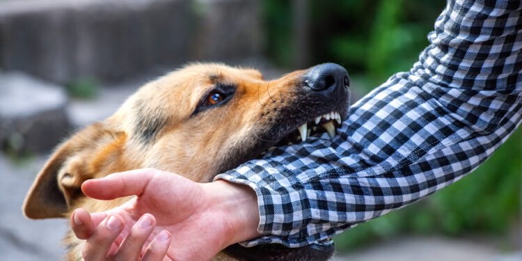 ನಾಯಿದಾಳಿ : ಮೀಟರ್ ರೀಡರ್‌ಗೆ ಕೈಗೆ ಗಂಭೀರ ಗಾಯ….!