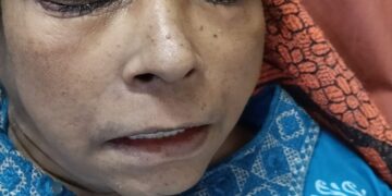 ಗಂಭೀರ ಸ್ಥಿತಿಯಲ್ಲಿದ್ದ ಮಹಿಳೆಯ ರಕ್ಷಣೆ: ಸಮಾಜಸೇವಕರಿಂದ ಆಸ್ಪತ್ರೆಗೆ ದಾಖಲಾತಿ…!