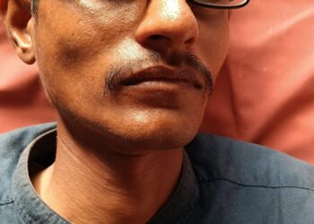 ಬ್ರಹ್ಮಾವರದಲ್ಲಿ ಮಾನಸಿಕ ಅಸ್ವಸ್ಥ ವ್ಯಕ್ತಿ ರಕ್ಷಣೆ; ಜಿಲ್ಲಾಸ್ಪತ್ರೆಗೆ ದಾಖಲು..!